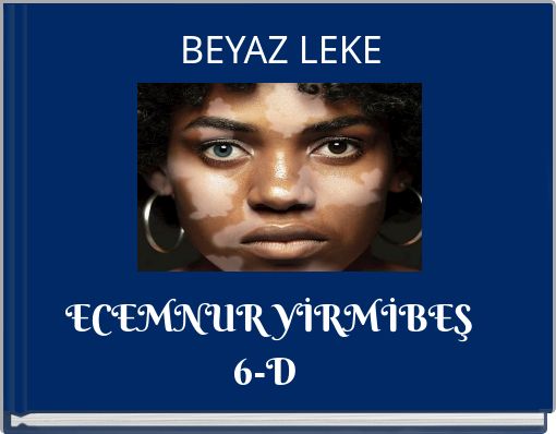 BEYAZ LEKE