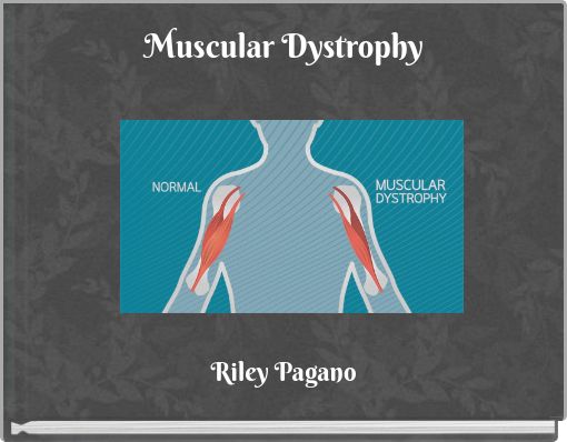 Muscular Dystrophy