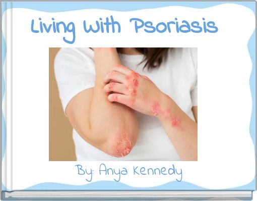 Living With Psoriasis