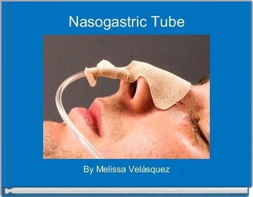 Nasogastric Tube