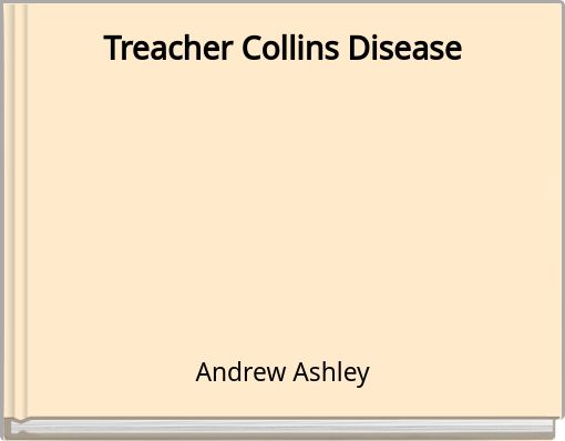Treacher Collins Disease