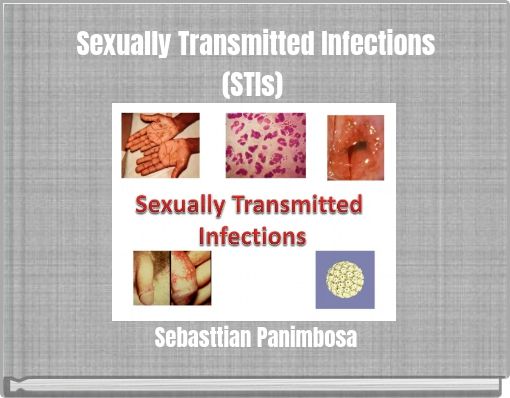 Sexually Transmitted Infections (STIs)