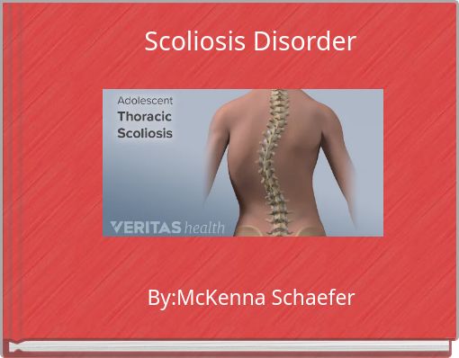 Scoliosis Disorder