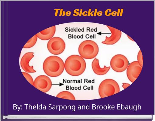 The Sickle Cell