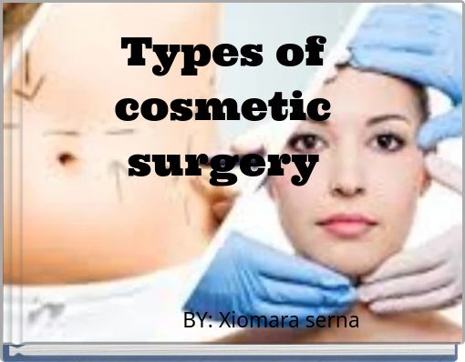 Types of cosmetic surgery