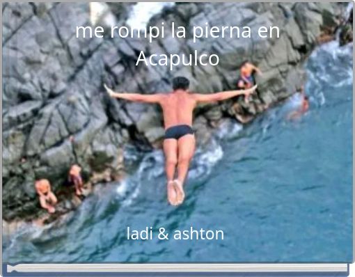 me rompi la pierna en Acapulco