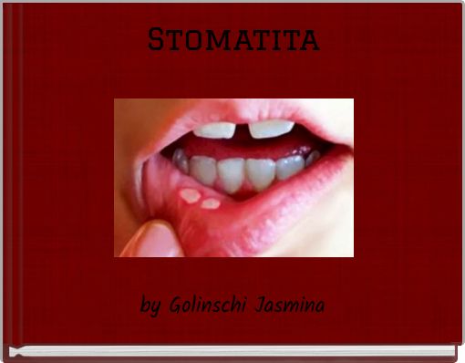 Stomatita