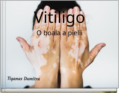 VitiligoO boala a pielii