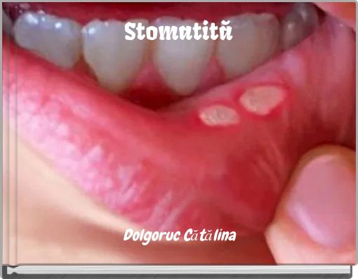 Stomatită
