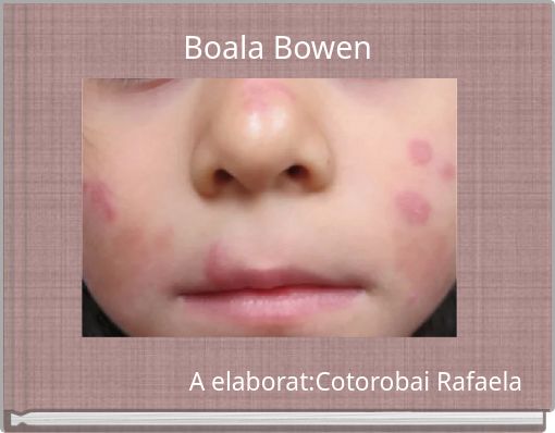 Boala Bowen