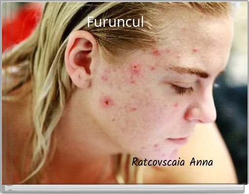 Furuncul